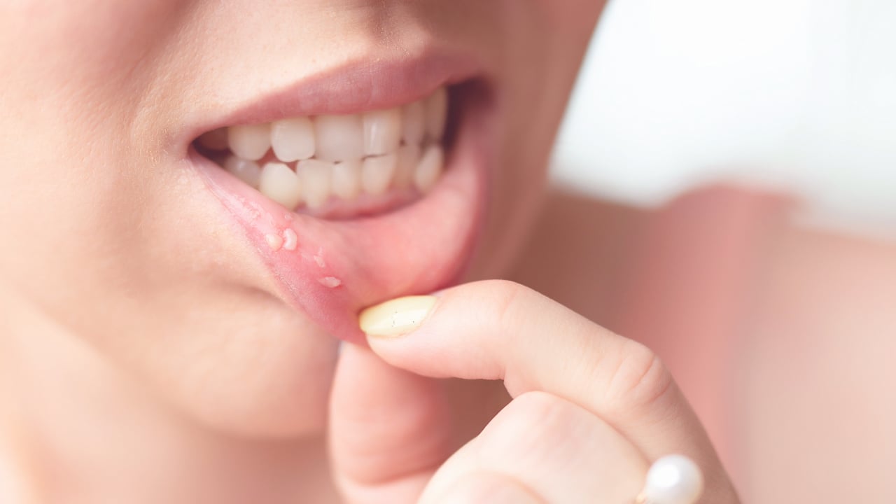 GSD-Canker-Sores-Symptoms-Blog-03.26.25-3