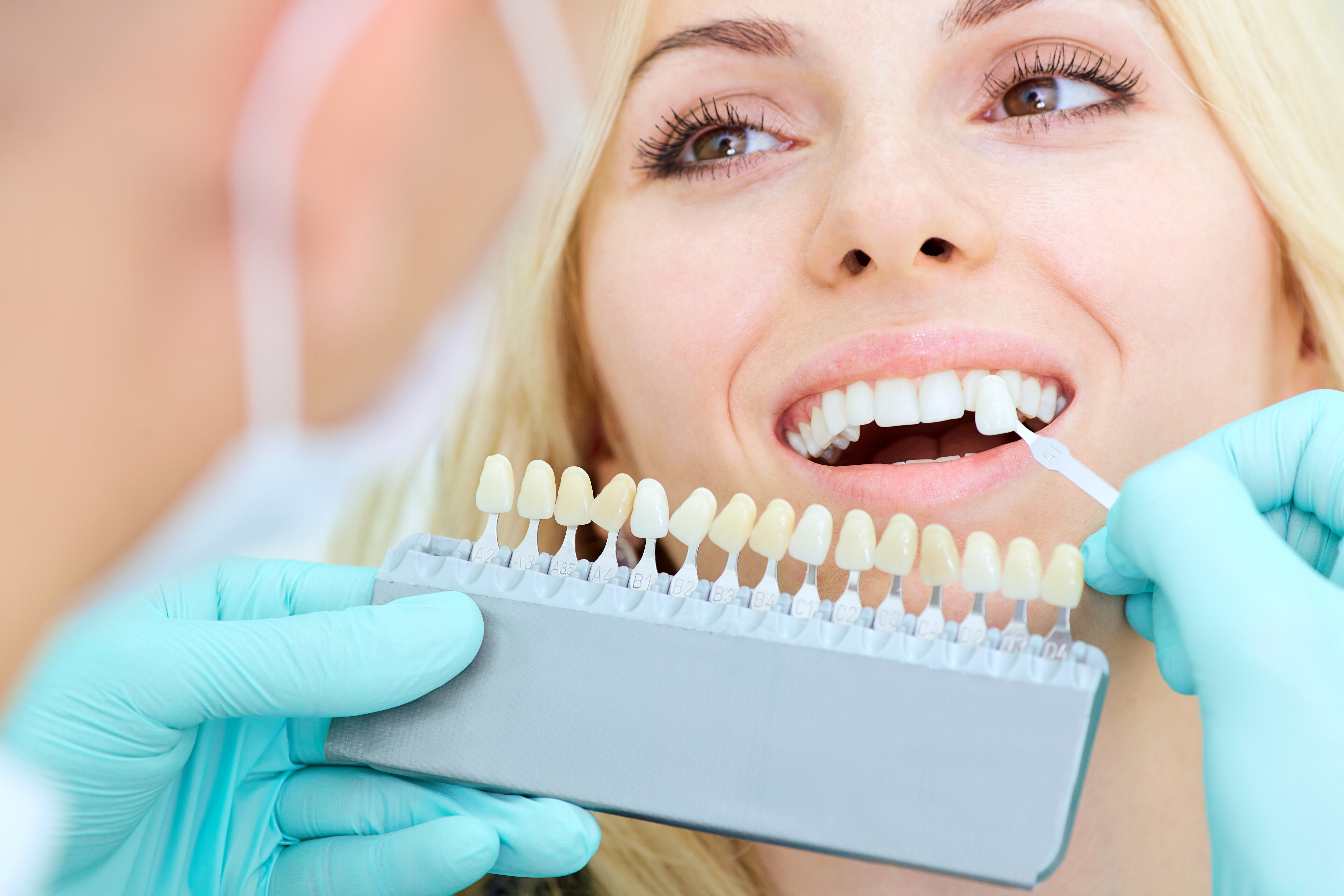 GSD-Teeth-Whitening-Methods-Blog