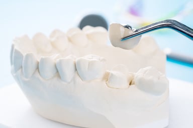 Dental Crowns: Purpose, Types, Procedure, Care, and Cost