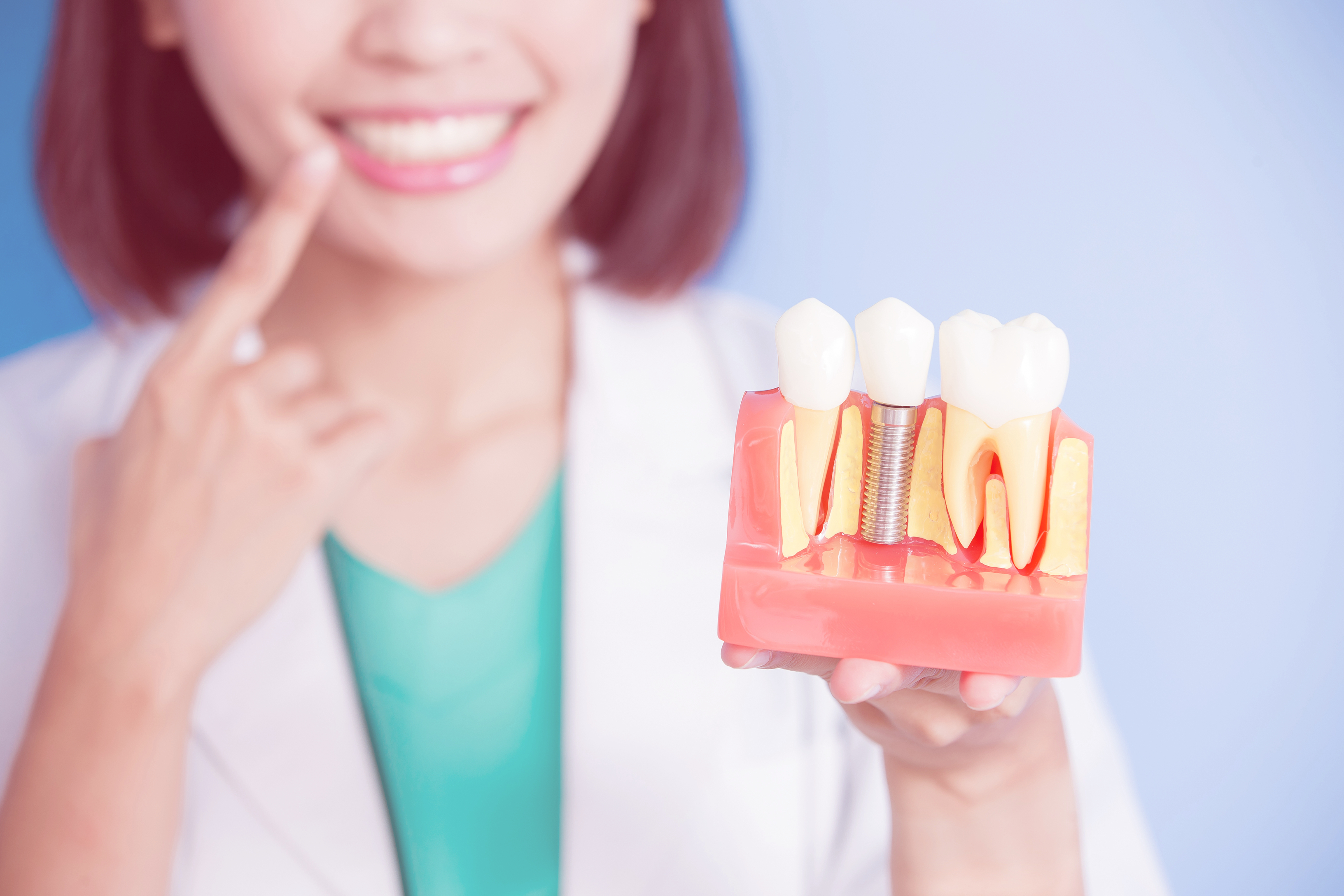 Dental Implants 7 Common Questions Answered