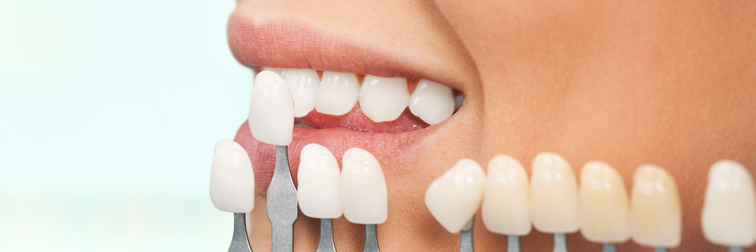 GSD-Professional-Teeth-Whitening-Dentist-WalnutCreek-LandingPage