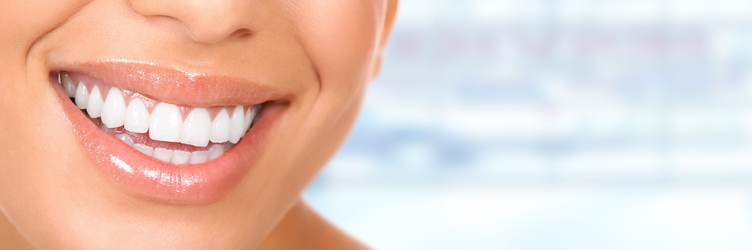 GSD-Schedule-Teeth-Whitening-Holidays-WalnutCreek