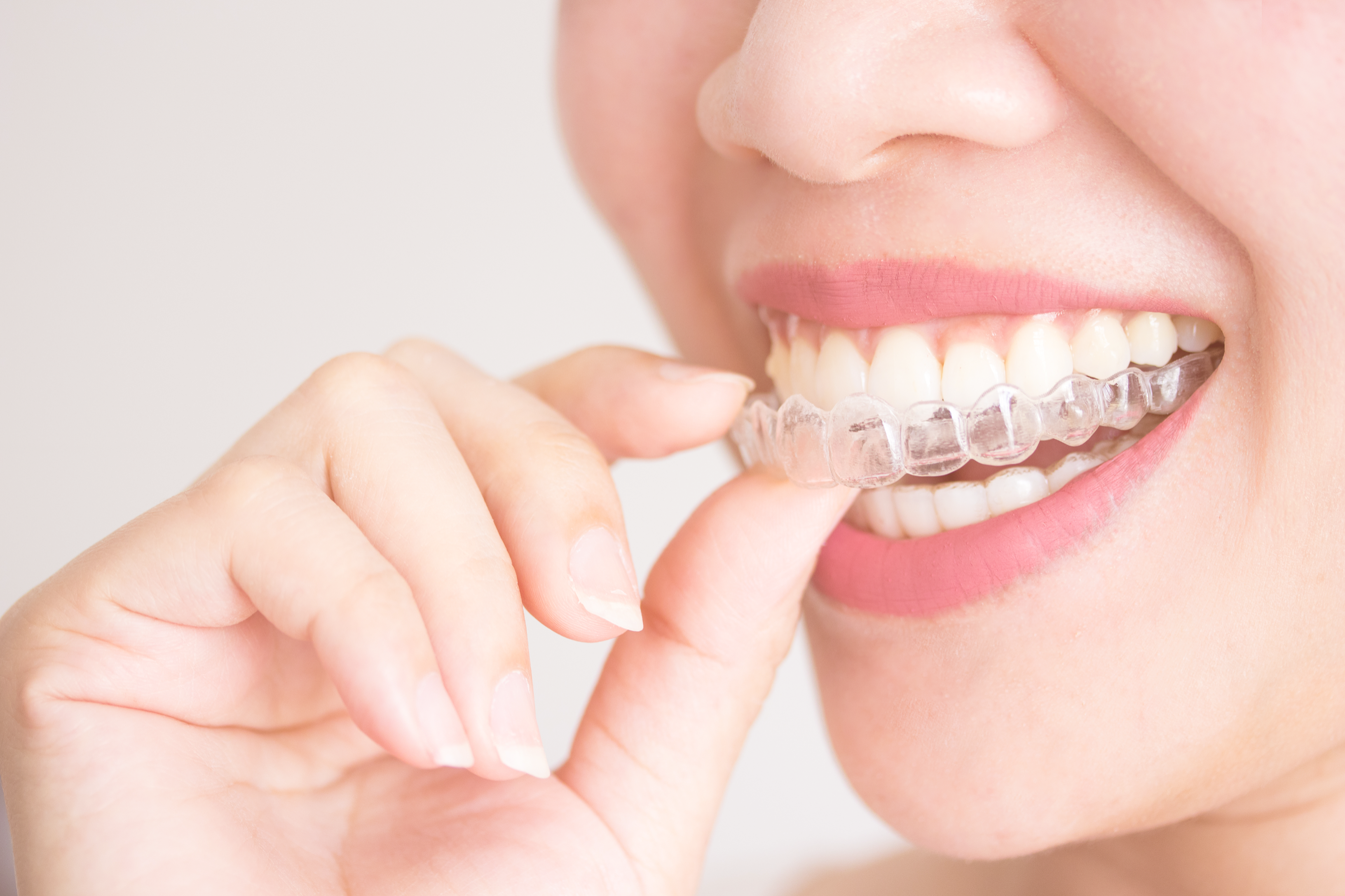 Walnut Creek CA Orthodontics, Braces, Invisalign - Majeroni