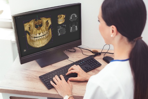 3D Cone Beam CT Scanner - Dental Technology